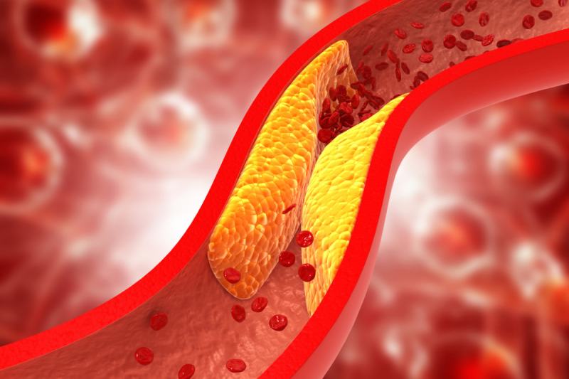 Symptoms of Blocked Arteries at Night: 5 Indications Your Legs and Feet May Show