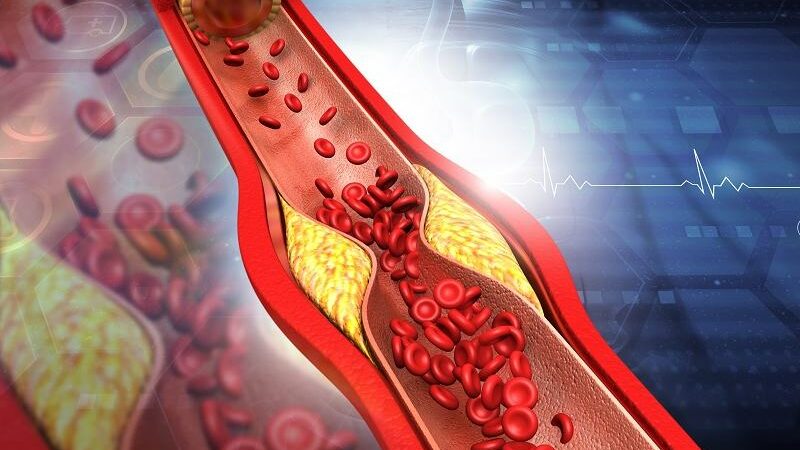 Clogged Arteries: 6 Nighttime Routines to Naturally Remove Plaque Formation